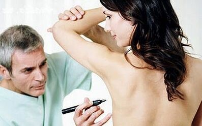 Mammary surgical method
