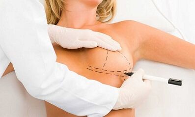 How to increase the implant cerebrals